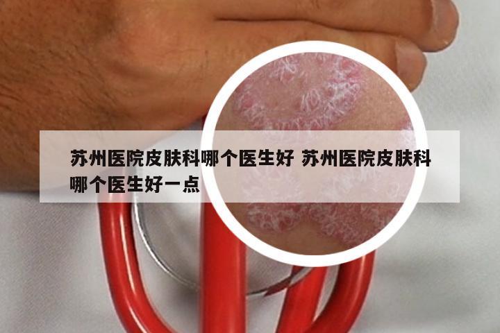 苏州医院皮肤科哪个医生好 苏州医院皮肤科哪个医生好一点