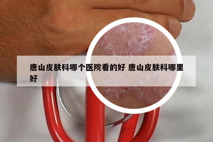 唐山皮肤科哪个医院看的好 唐山皮肤科哪里好