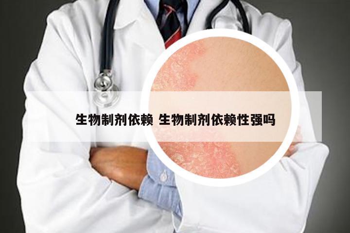 生物制剂依赖 生物制剂依赖性强吗