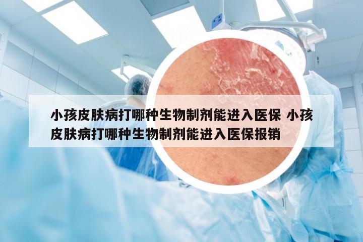 小孩皮肤病打哪种生物制剂能进入医保 小孩皮肤病打哪种生物制剂能进入医保报销