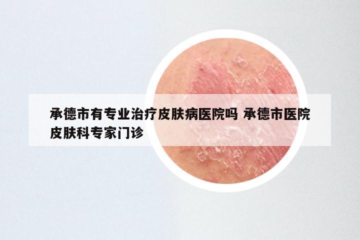 承德市有专业治疗皮肤病医院吗 承德市医院皮肤科专家门诊