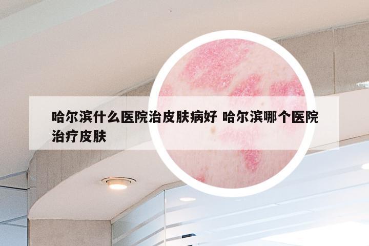 哈尔滨什么医院治皮肤病好 哈尔滨哪个医院治疗皮肤