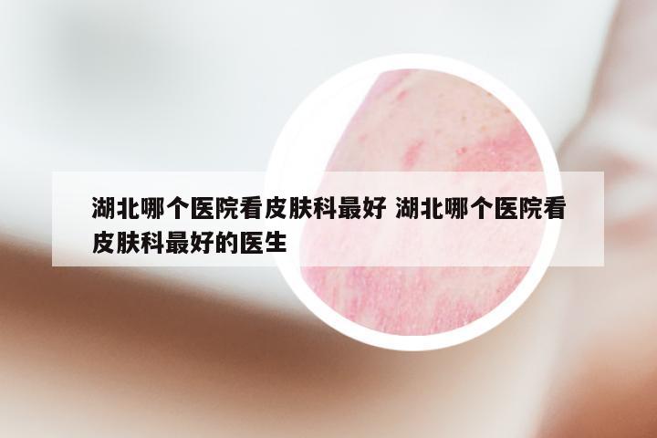 湖北哪个医院看皮肤科最好 湖北哪个医院看皮肤科最好的医生