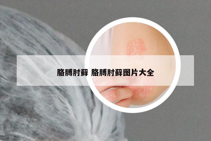 胳膊肘藓 胳膊肘藓图片大全