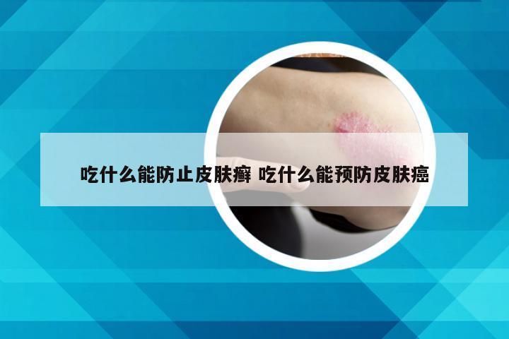 吃什么能防止皮肤癣 吃什么能预防皮肤癌