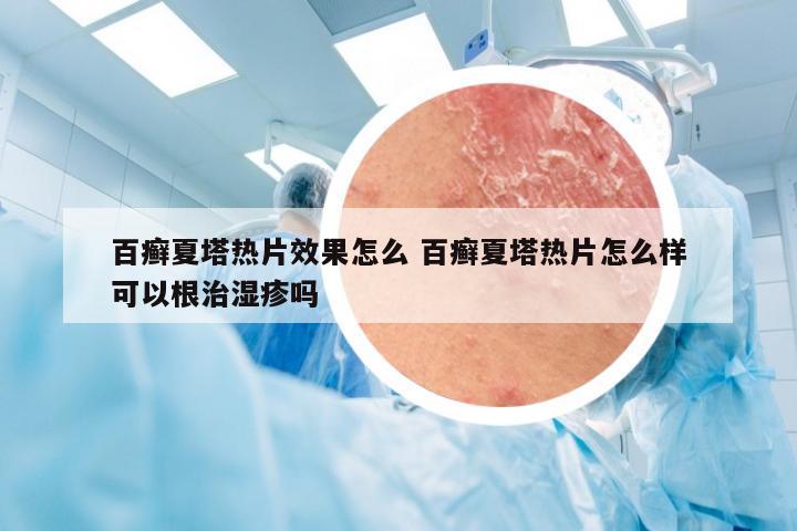 百癣夏塔热片效果怎么 百癣夏塔热片怎么样可以根治湿疹吗