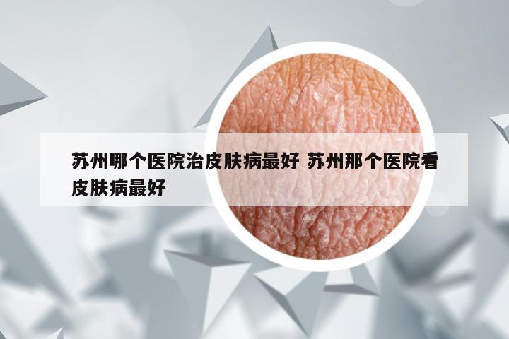 苏州哪个医院治皮肤病最好 苏州那个医院看皮肤病最好