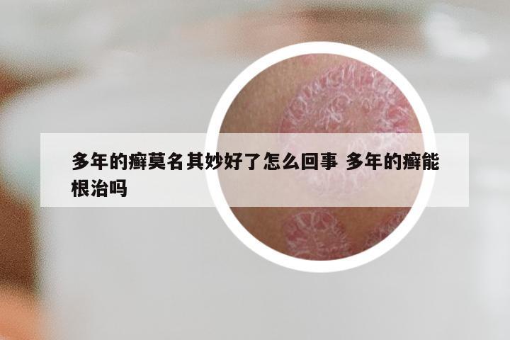 多年的癣莫名其妙好了怎么回事 多年的癣能根治吗
