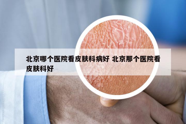 北京哪个医院看皮肤科病好 北京那个医院看皮肤科好