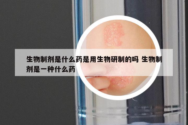 生物制剂是什么药是用生物研制的吗 生物制剂是一种什么药