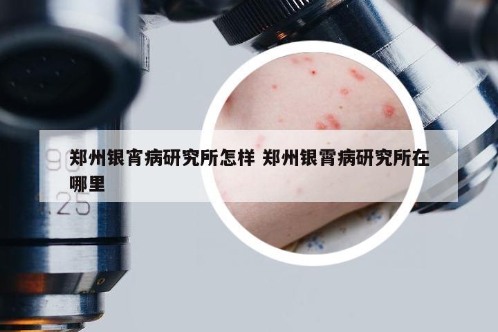 郑州银宵病研究所怎样 郑州银霄病研究所在哪里