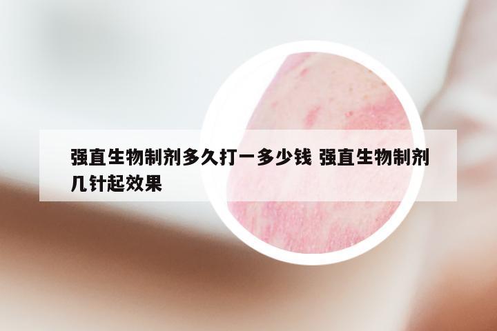 强直生物制剂多久打一多少钱 强直生物制剂几针起效果