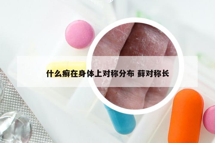 什么癣在身体上对称分布 藓对称长