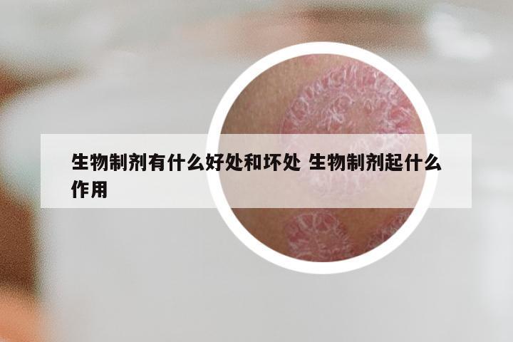 生物制剂有什么好处和坏处 生物制剂起什么作用