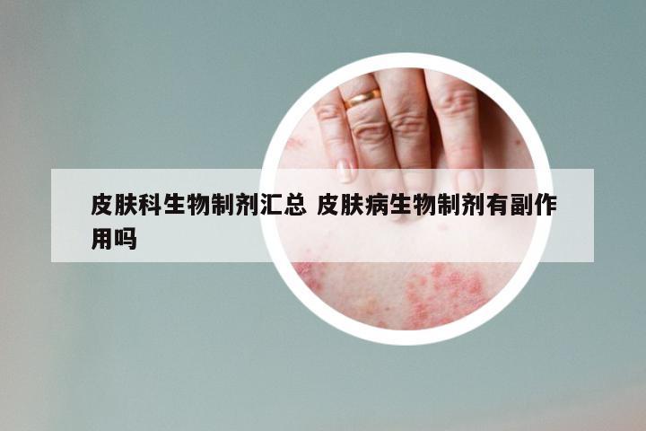 皮肤科生物制剂汇总 皮肤病生物制剂有副作用吗