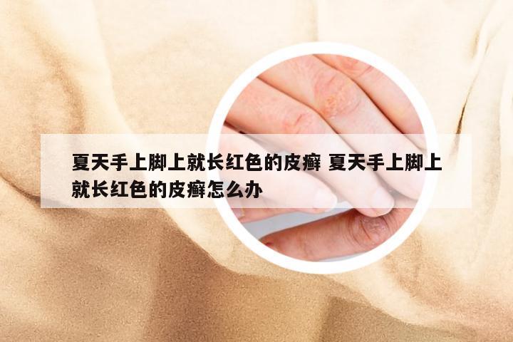 夏天手上脚上就长红色的皮癣 夏天手上脚上就长红色的皮癣怎么办