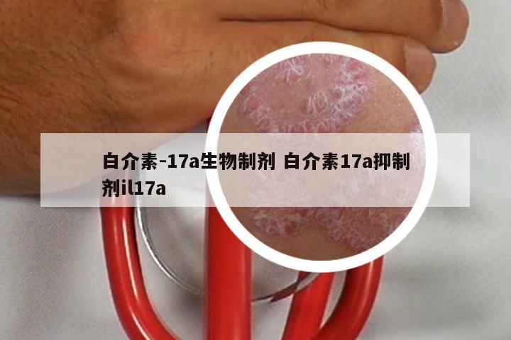 白介素-17a生物制剂 白介素17a抑制剂il17a