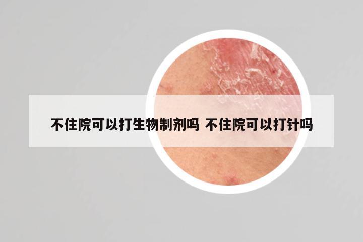 不住院可以打生物制剂吗 不住院可以打针吗