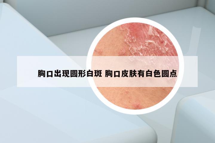 胸口出现圆形白斑 胸口皮肤有白色圆点