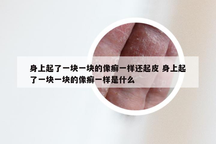 身上起了一块一块的像癣一样还起皮 身上起了一块一块的像癣一样是什么