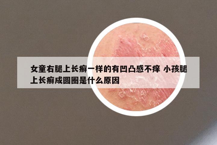 女童右腿上长癣一样的有凹凸感不痒 小孩腿上长癣成圆圈是什么原因