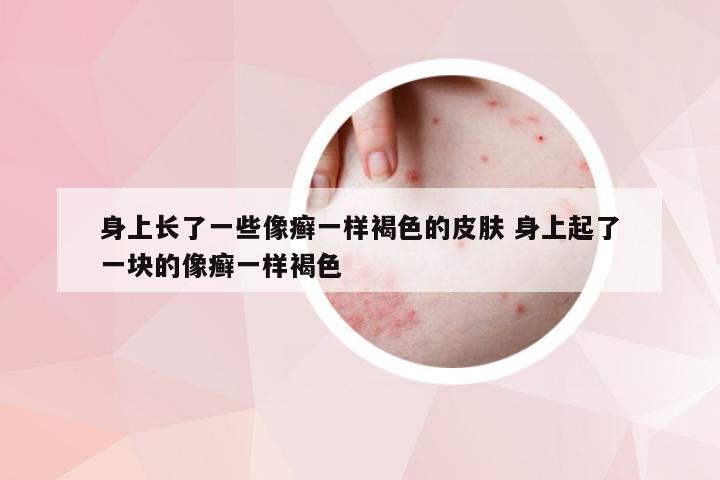 身上长了一些像癣一样褐色的皮肤 身上起了一块的像癣一样褐色