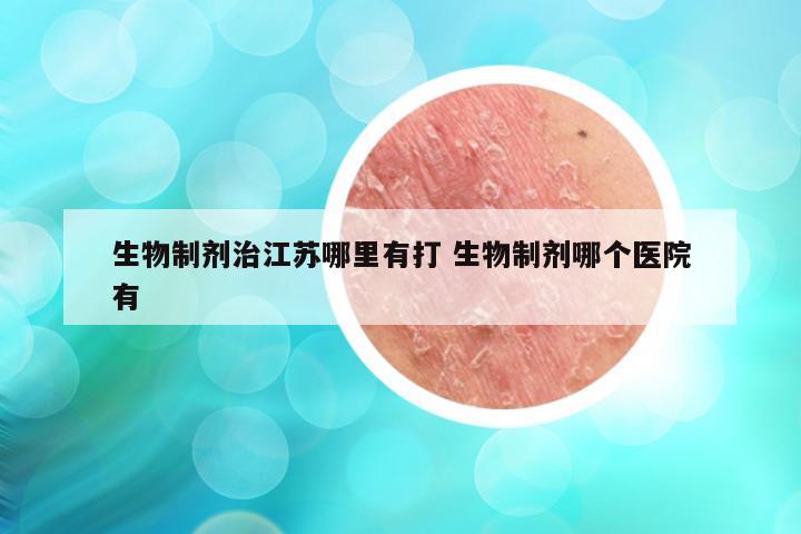 生物制剂治江苏哪里有打 生物制剂哪个医院有