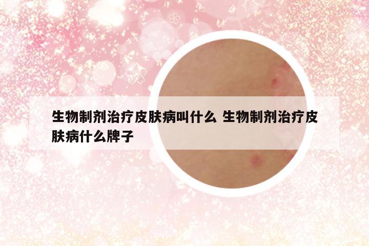 生物制剂治疗皮肤病叫什么 生物制剂治疗皮肤病什么牌子