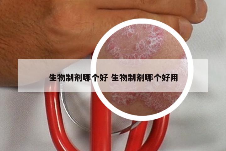生物制剂哪个好 生物制剂哪个好用
