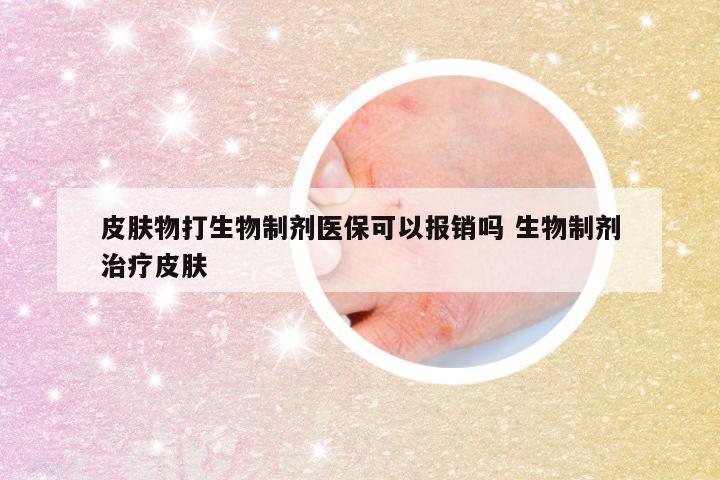 皮肤物打生物制剂医保可以报销吗 生物制剂治疗皮肤