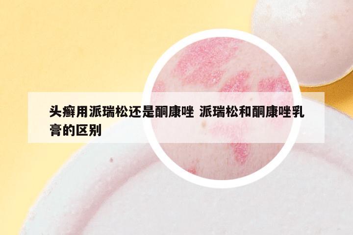 头癣用派瑞松还是酮康唑 派瑞松和酮康唑乳膏的区别