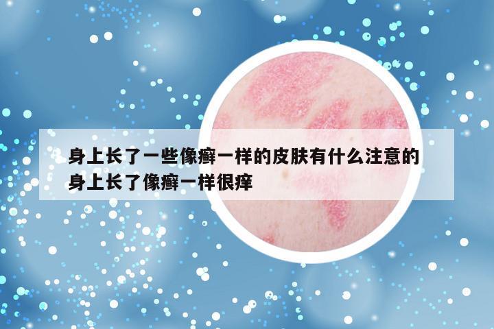身上长了一些像癣一样的皮肤有什么注意的 身上长了像癣一样很痒