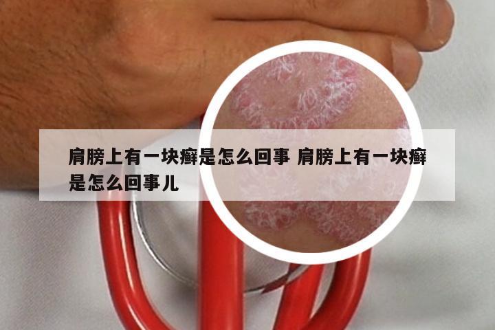 肩膀上有一块癣是怎么回事 肩膀上有一块癣是怎么回事儿
