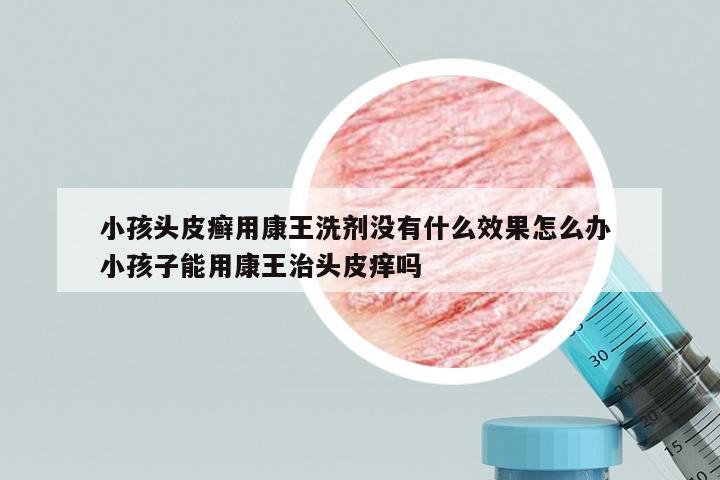 小孩头皮癣用康王洗剂没有什么效果怎么办 小孩子能用康王治头皮痒吗