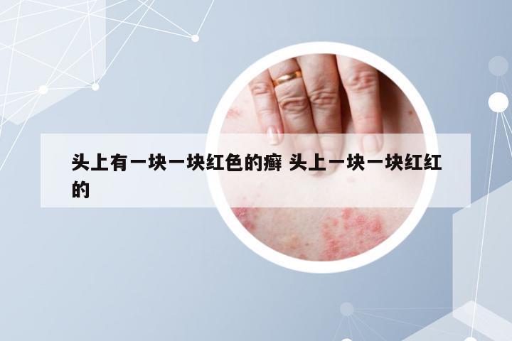头上有一块一块红色的癣 头上一块一块红红的