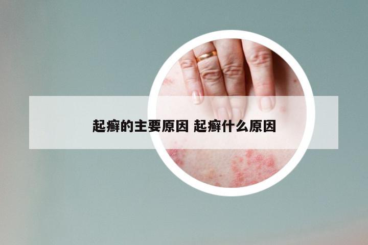起癣的主要原因 起癣什么原因