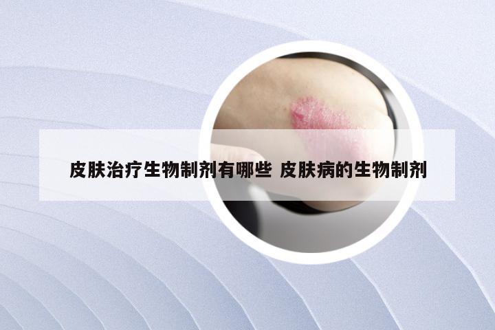 皮肤治疗生物制剂有哪些 皮肤病的生物制剂