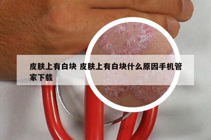 皮肤上有白块 皮肤上有白块什么原因手机管家下载