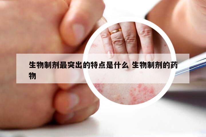 生物制剂最突出的特点是什么 生物制剂的药物