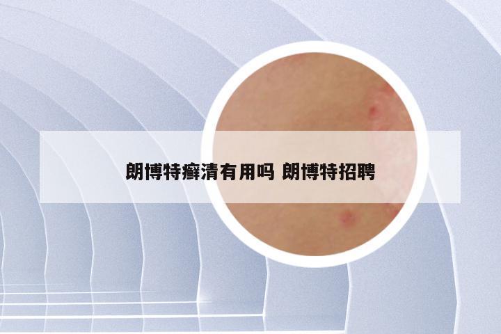 朗博特癣清有用吗 朗博特招聘