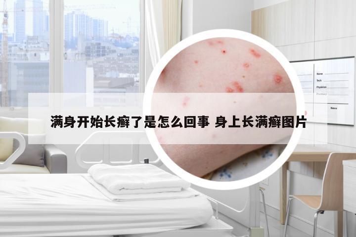 满身开始长癣了是怎么回事 身上长满癣图片