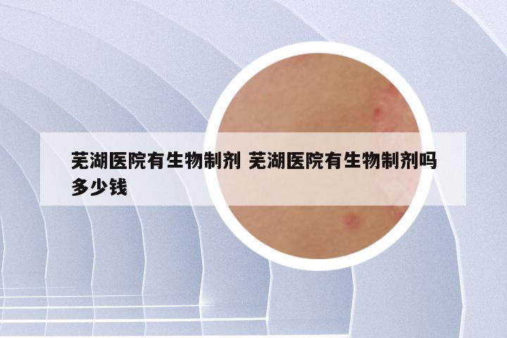 芜湖医院有生物制剂 芜湖医院有生物制剂吗多少钱