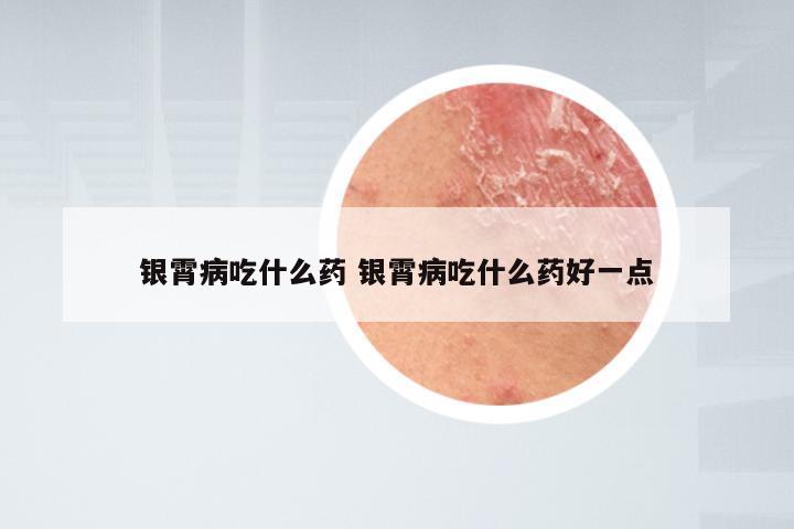 银霄病吃什么药 银霄病吃什么药好一点