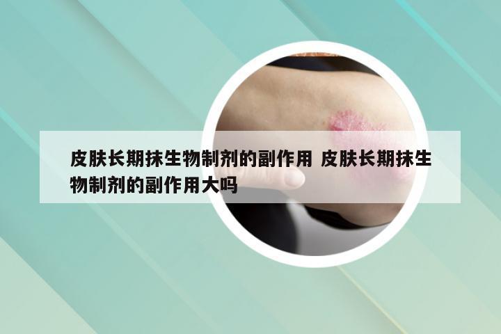 皮肤长期抹生物制剂的副作用 皮肤长期抹生物制剂的副作用大吗