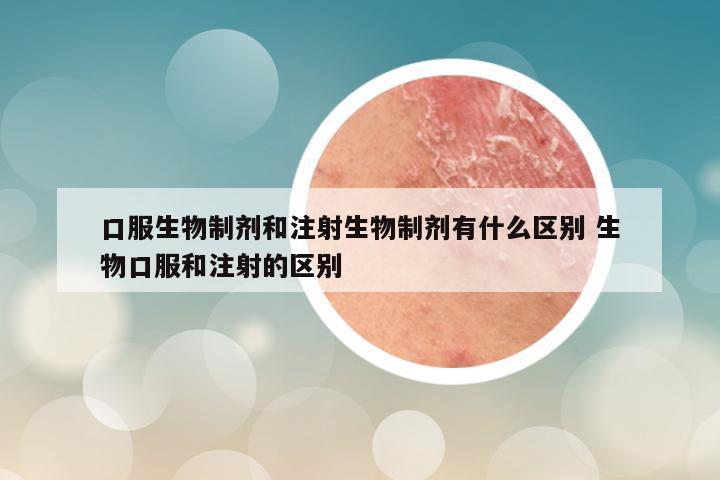 口服生物制剂和注射生物制剂有什么区别 生物口服和注射的区别