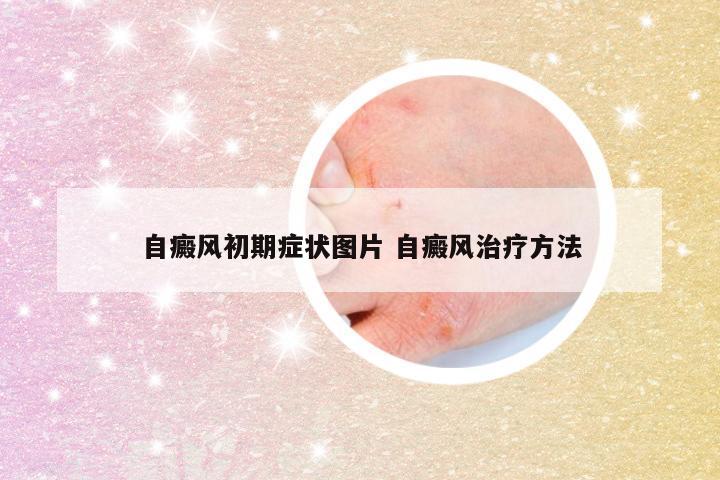 自癜风初期症状图片 自癜风治疗方法
