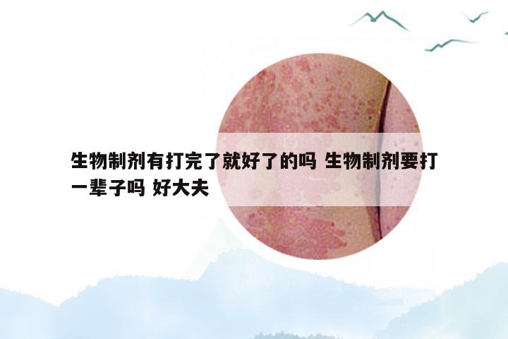 生物制剂有打完了就好了的吗 生物制剂要打一辈子吗 好大夫