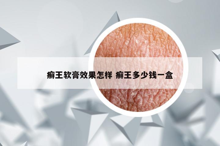 癣王软膏效果怎样 癣王多少钱一盒