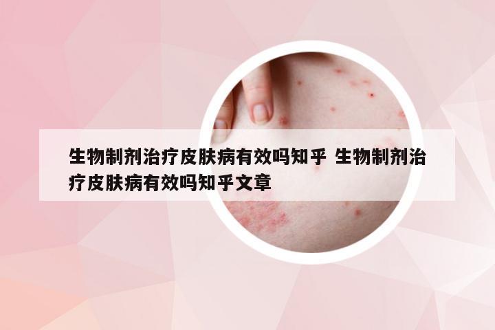生物制剂治疗皮肤病有效吗知乎 生物制剂治疗皮肤病有效吗知乎文章