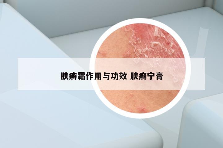 肤癣霜作用与功效 肤癣宁膏